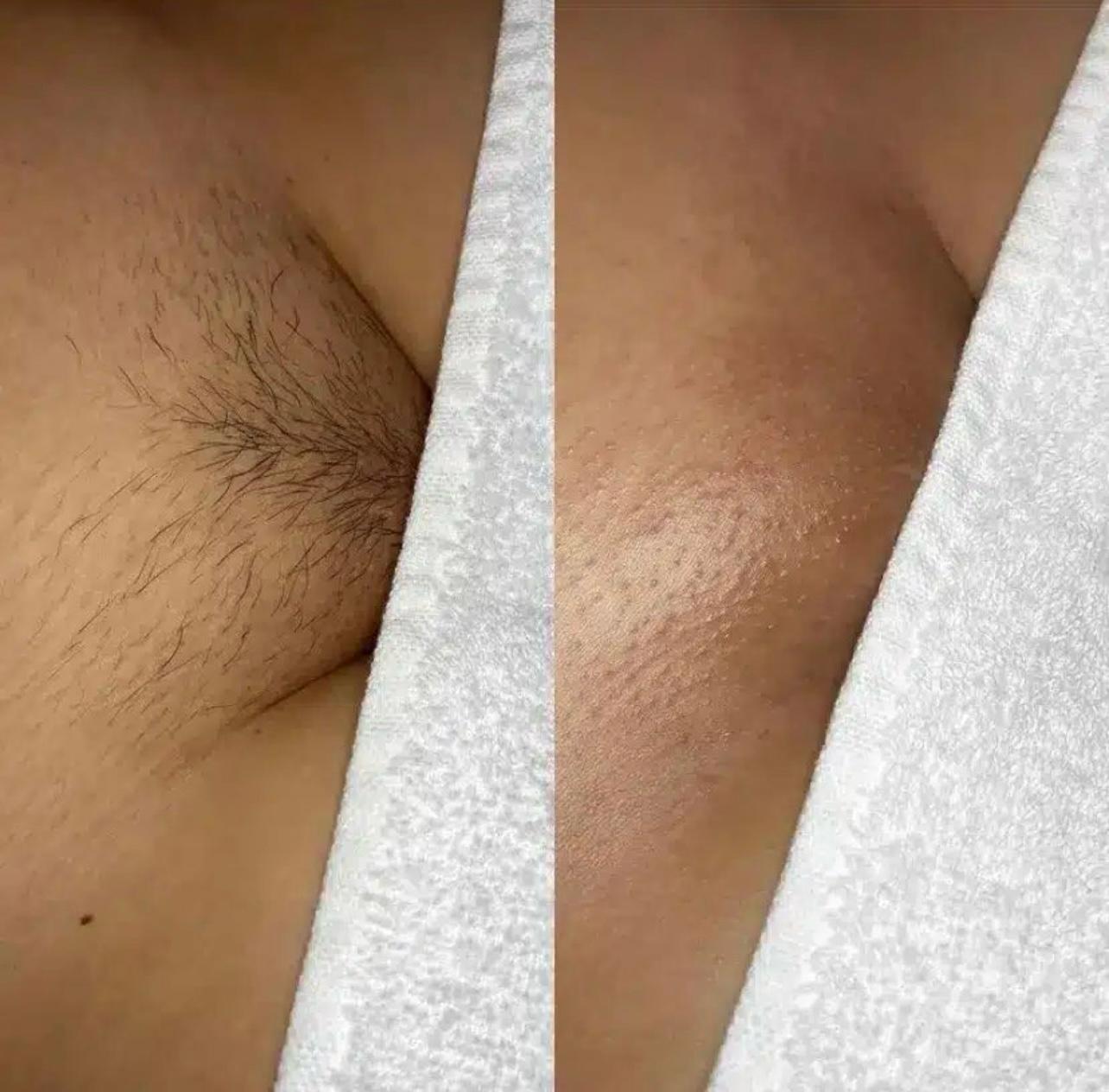 Brazilian Wax Near You: Smooth Confidence Starts at Browz&Co